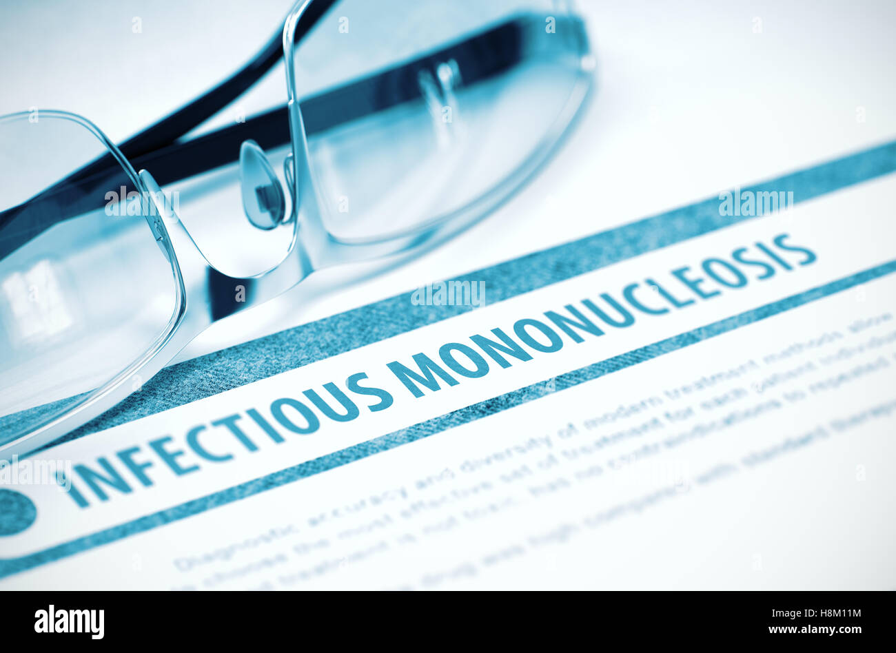 Mononucleosis infecciosa. La medicina. Ilustración 3D. Foto de stock