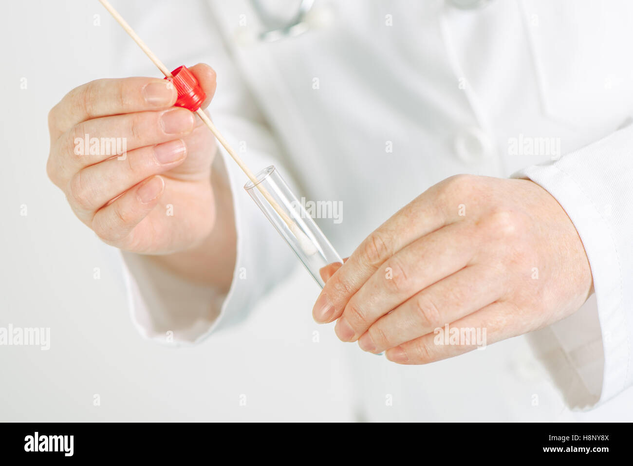 Ginecóloga mantiene muestras cervicales desechables hisopo y tubo de ensayo  en el hospital, listo para la oficina médica ginecológica ex Fotografía de  stock - Alamy