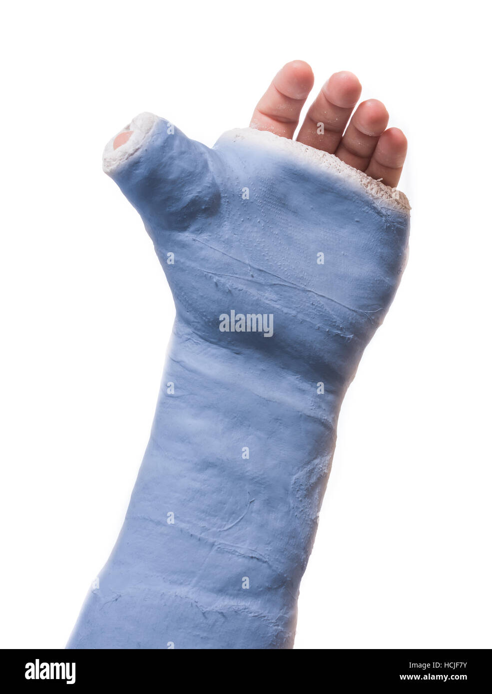 Cerca de un brazo azul / YESO yeso de fibra de vidrio con el pulgar  extendido en un Thumbs up forma, aislado en blanco Fotografía de stock -  Alamy