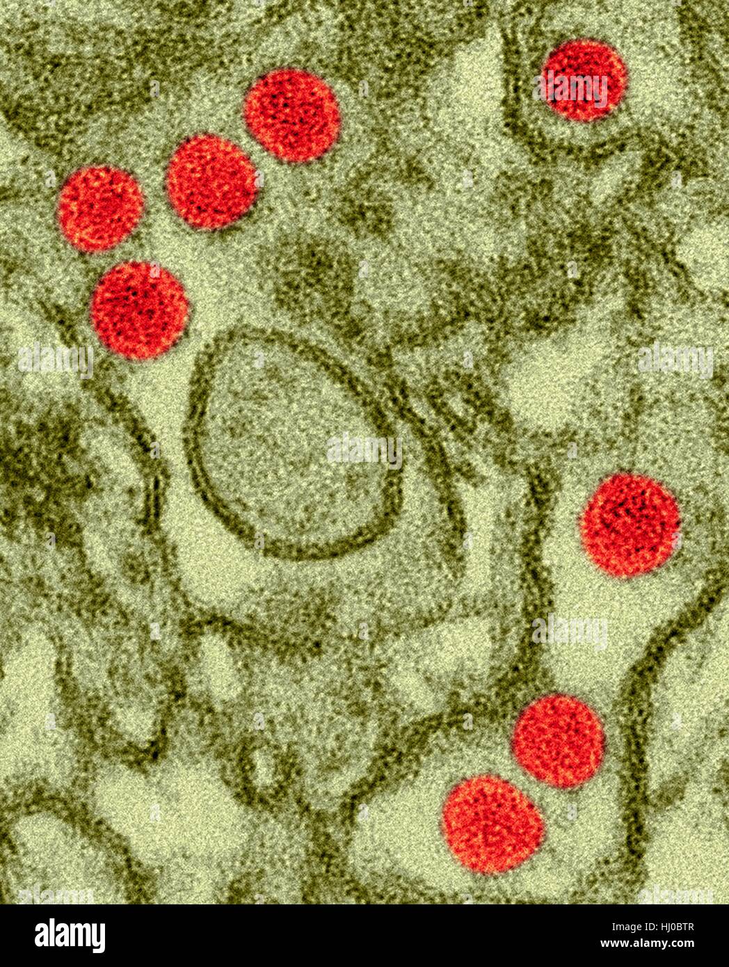 Color micrógrafo electrónico de transmisión (TEM) de partículas del virus Zika (rojo) aislados en células epiteliales renales (células Vero E6).Los virus Zika denso núcleo rodeado de sobres tamaño (40nm).Zika virus de ARN (ácido ribonucleico) de virus de la familia Flaviviridae provoca fiebre Zika,o enfermedad Zika.Aedes Foto de stock