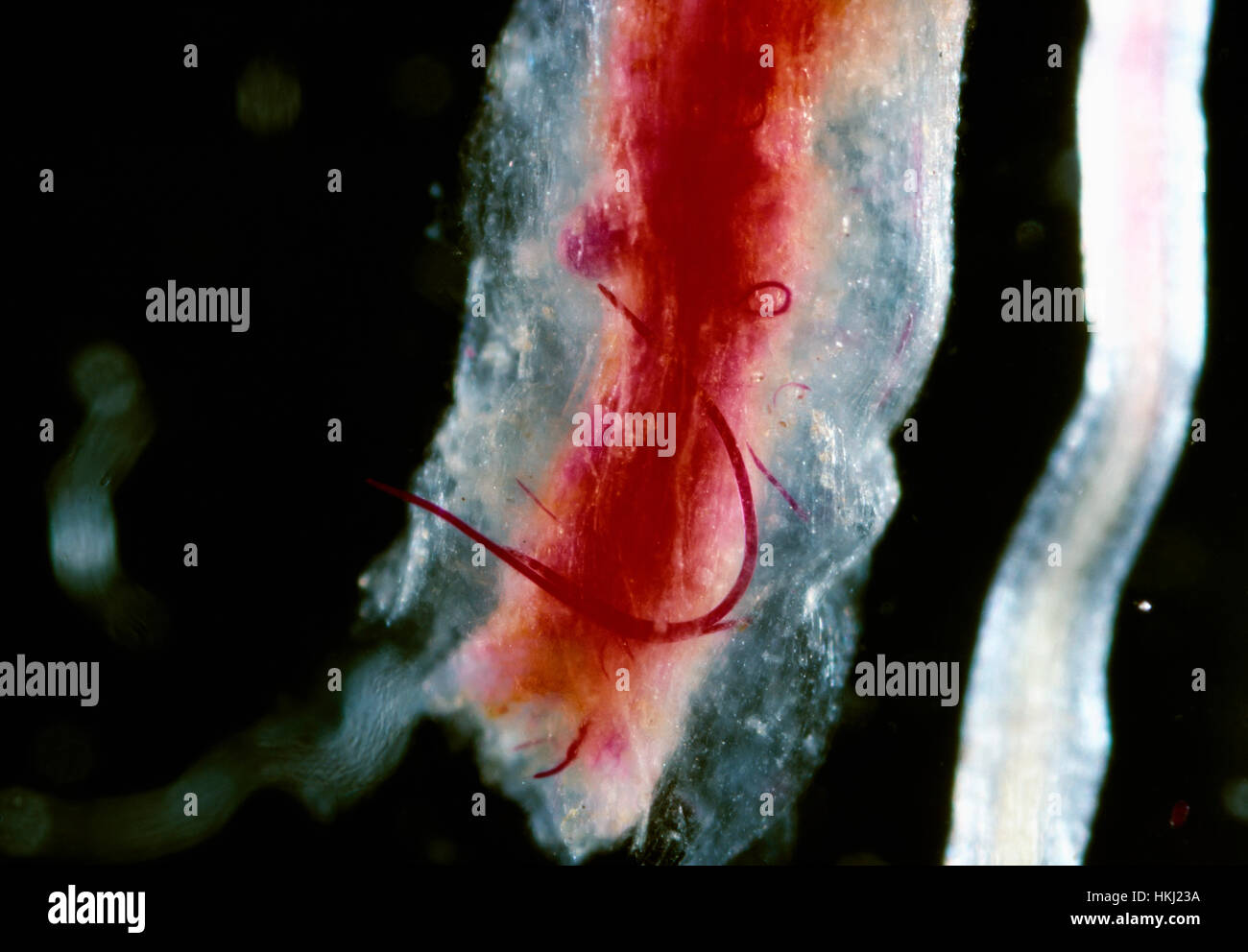 Agricultura - Rootknot nematodos (Meloidogyne incognita), macho maduro visibles en una raíz de algodón teñido de color rojo (largas y delgadas hacia atrás Foto de stock