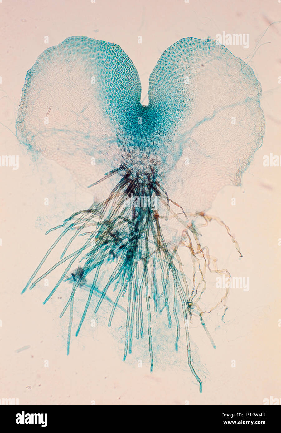 Fern prothallium (Pteridium sp), vistos bajo el microscopio. Foto de stock