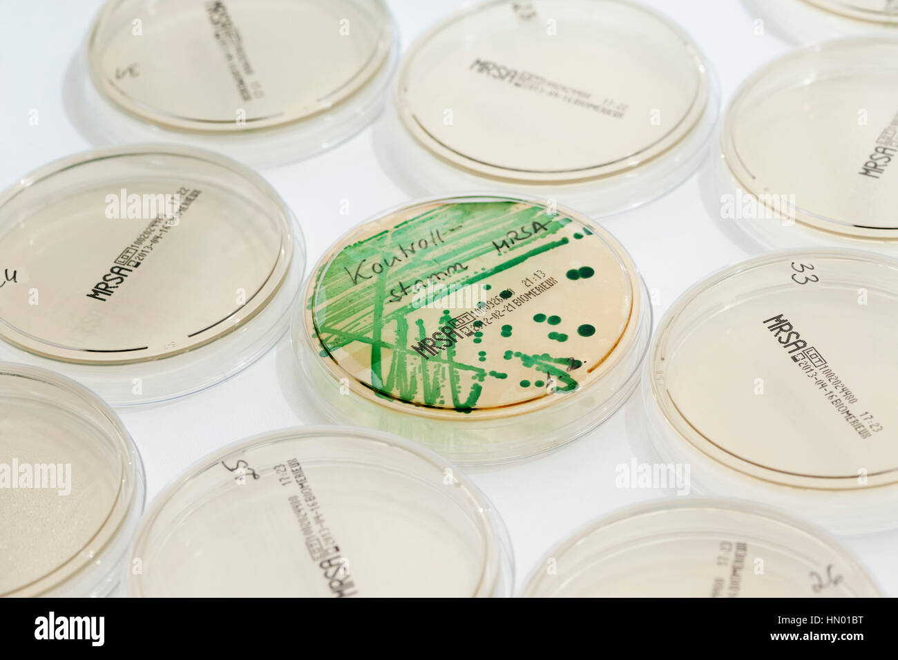 Diagnóstico microbiológico de las bacterias SARM (Staphylococcus aureus resistente a la meticilina), placa de Petri con MRSA cepa de control Foto de stock