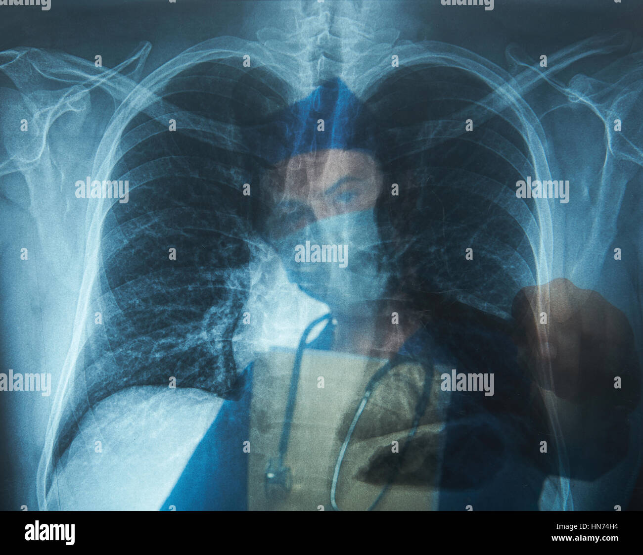 Enfermera hombre apuntando a pulmón la imagen de rayos x Foto de stock