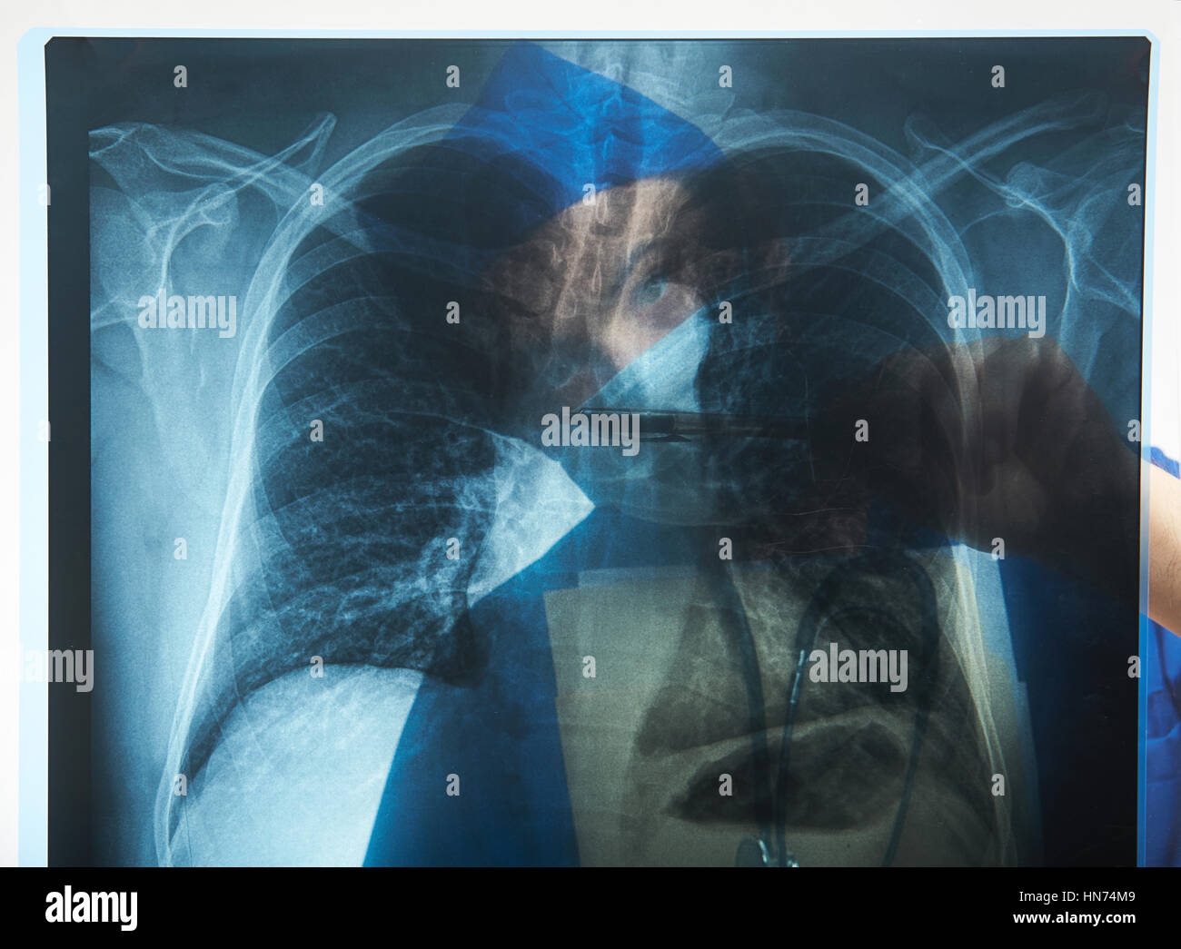 Doctor detrás de la imagen de rayos x de los pulmones Foto de stock