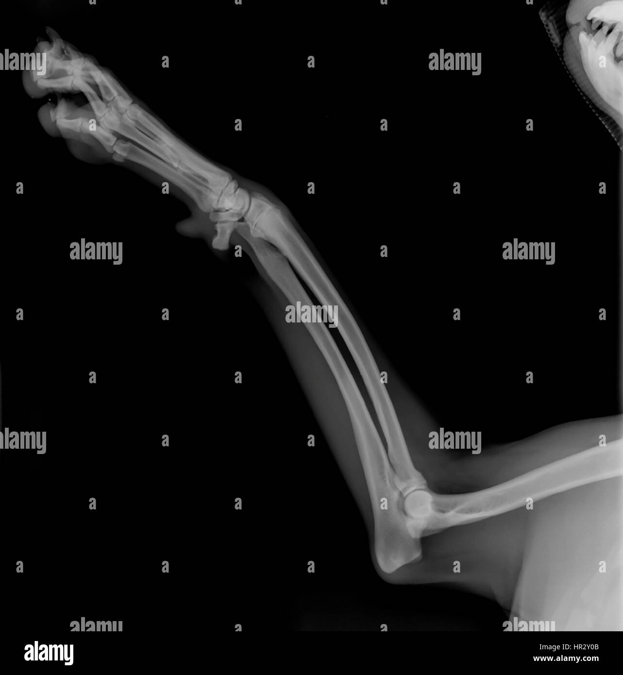 Rayos X de un perro de la pata delantera izquierda en una cirugía veterinaria Foto de stock
