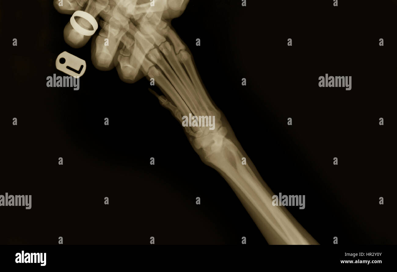 Rayos X de un perro de la pata delantera izquierda en una cirugía veterinaria el técnico la mano que sostiene la pata puede verse Foto de stock