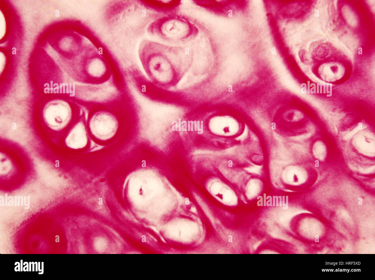 Cartílago hialino humano Fotografía de stock Alamy