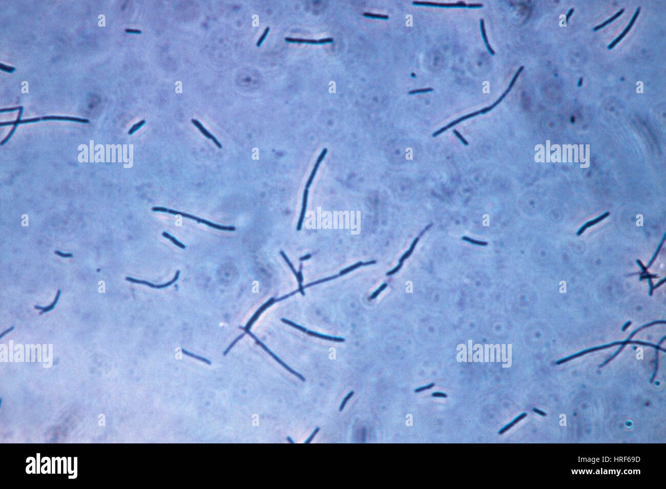 Lactobacillus acidophilus, LM Fotografía de stock - Alamy