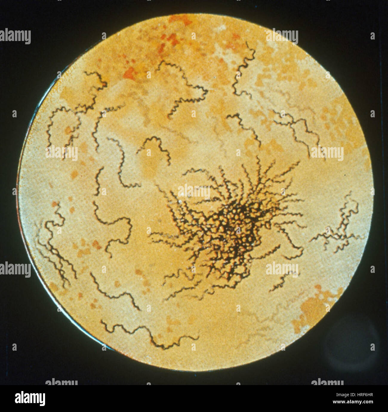 La bacteria treponema pallidum sífilis fotografías e imágenes de alta resolución Alamy La bacteria treponema pallidum sífilis fotografías e imágenes de alta resolución Alamy
