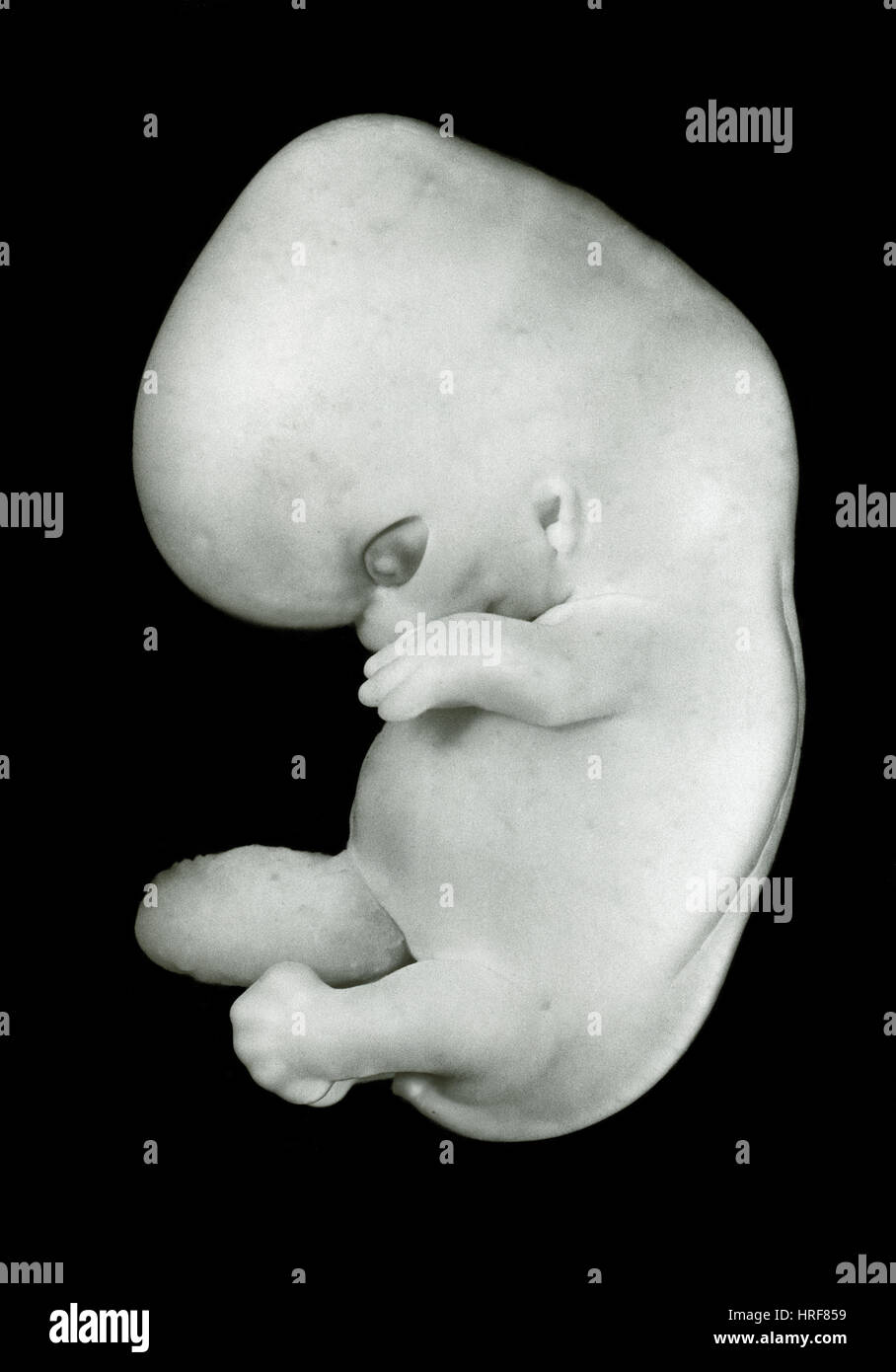44 Día de antigüedad embrión humano Foto de stock