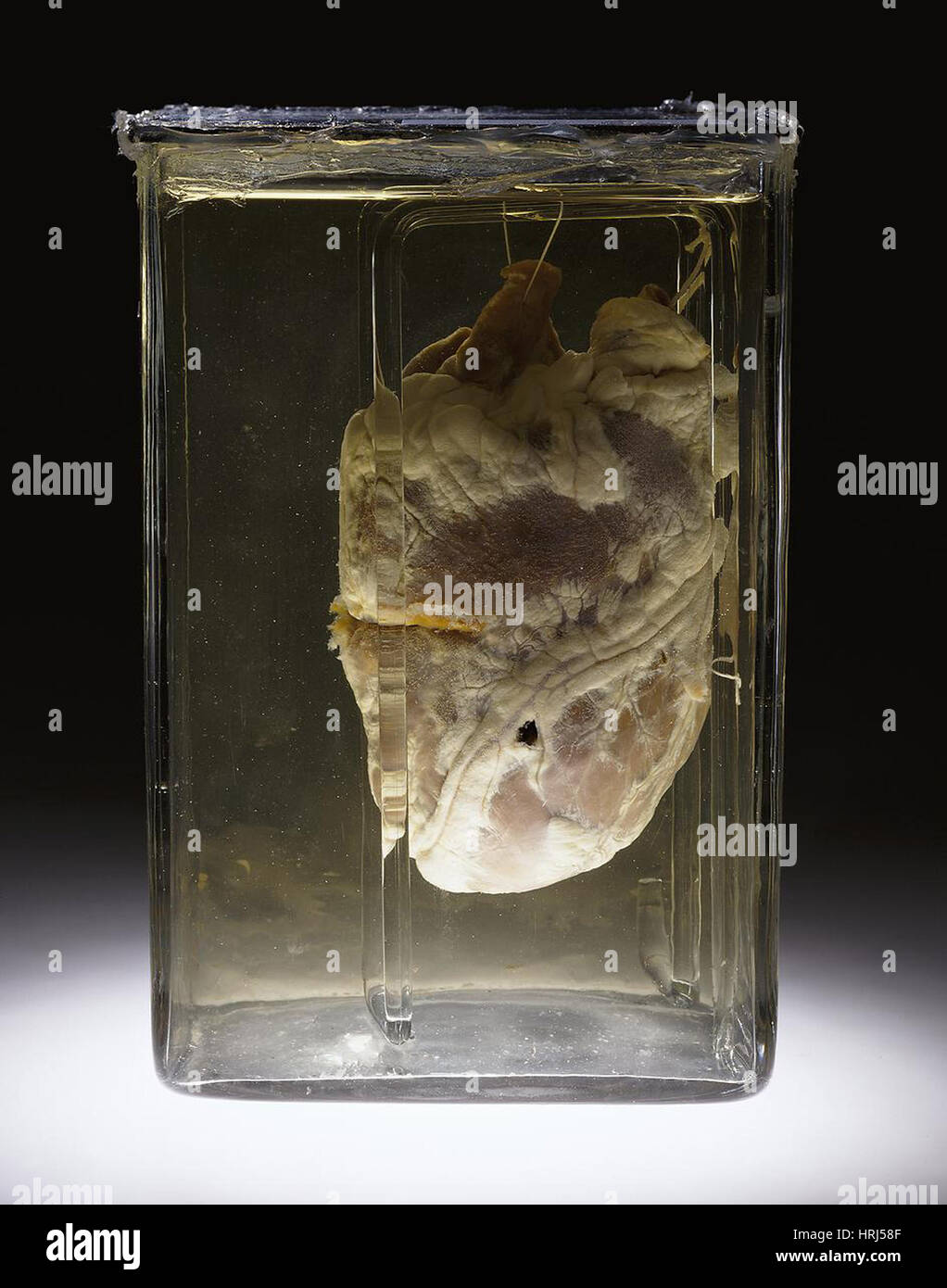 Las pruebas forenses, corazón perforado por bala, 1937 Foto de stock