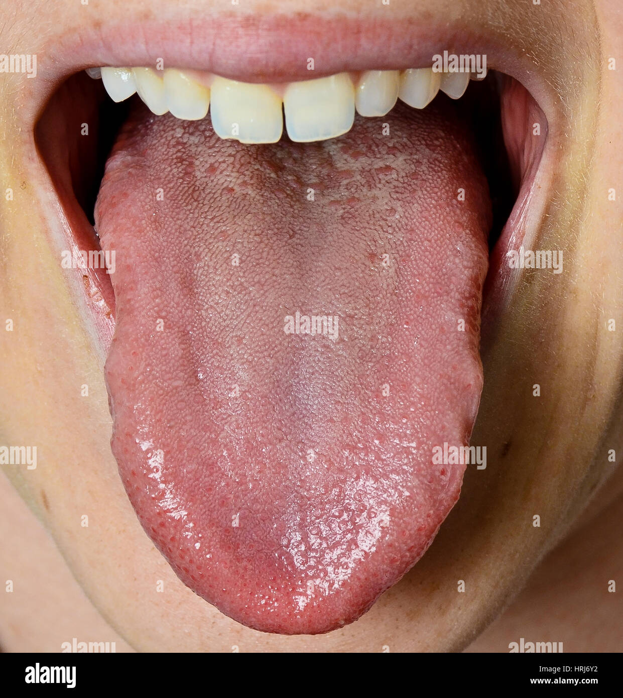 My Image 5