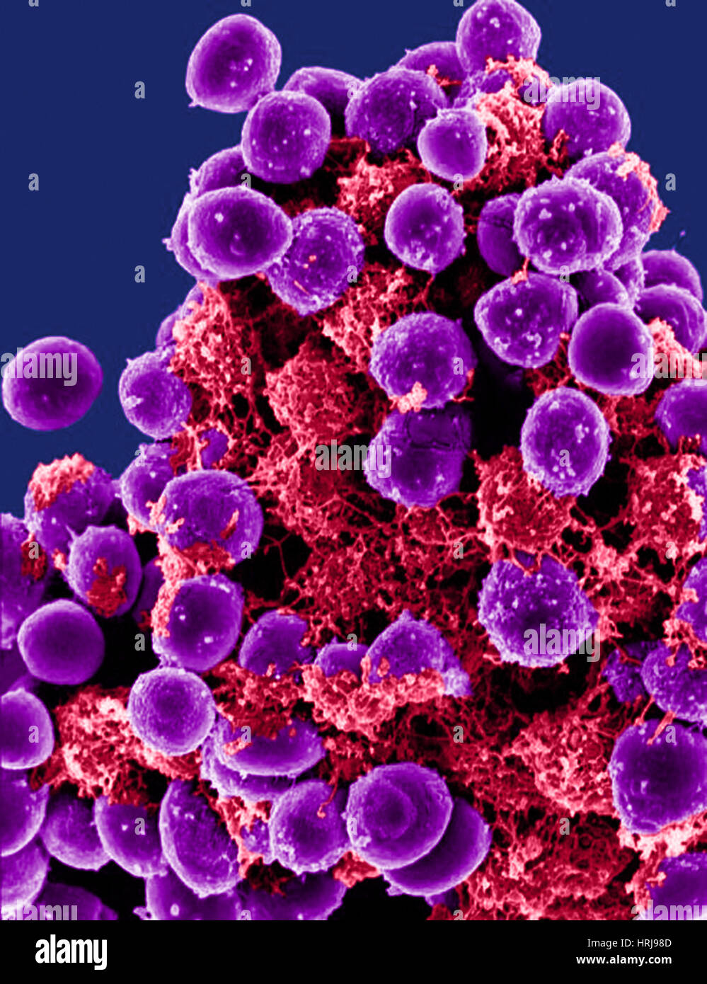 Staphylococcus epidermidis, SEM Fotografía de stock Alamy Staphylococcus epidermidis, SEM Fotografía de stock Alamy