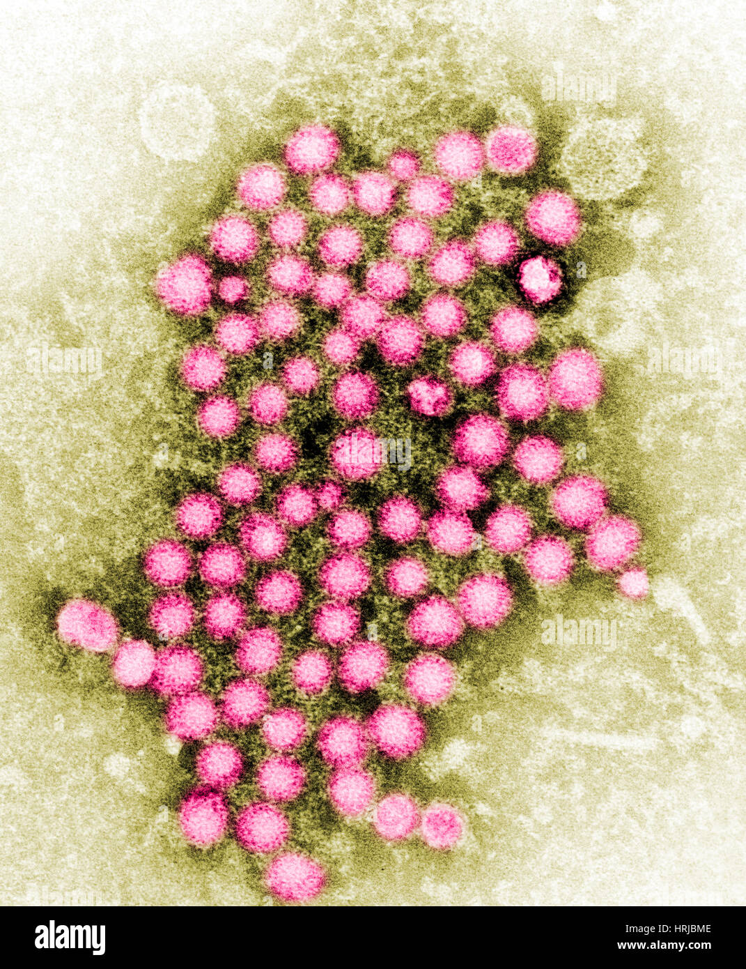 Virus de la hepatitis, cepa desconocida, TEM Foto de stock
