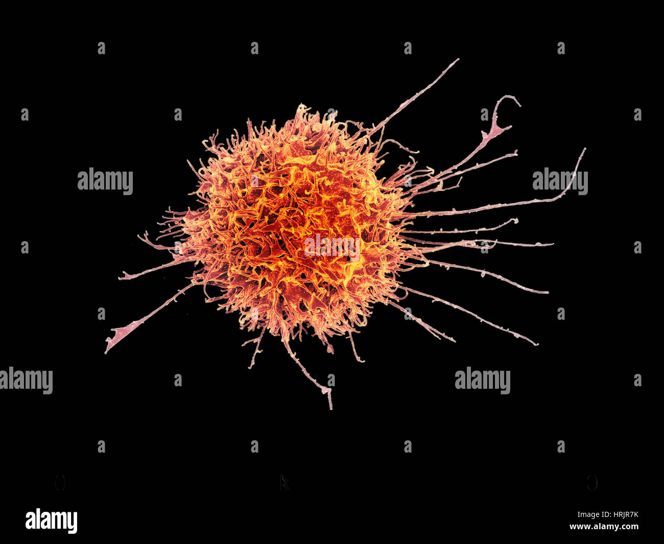 Derechos de las células asesinas naturales, SEM Fotografía de stock Alamy Derechos de las células asesinas naturales, SEM Fotografía de stock Alamy