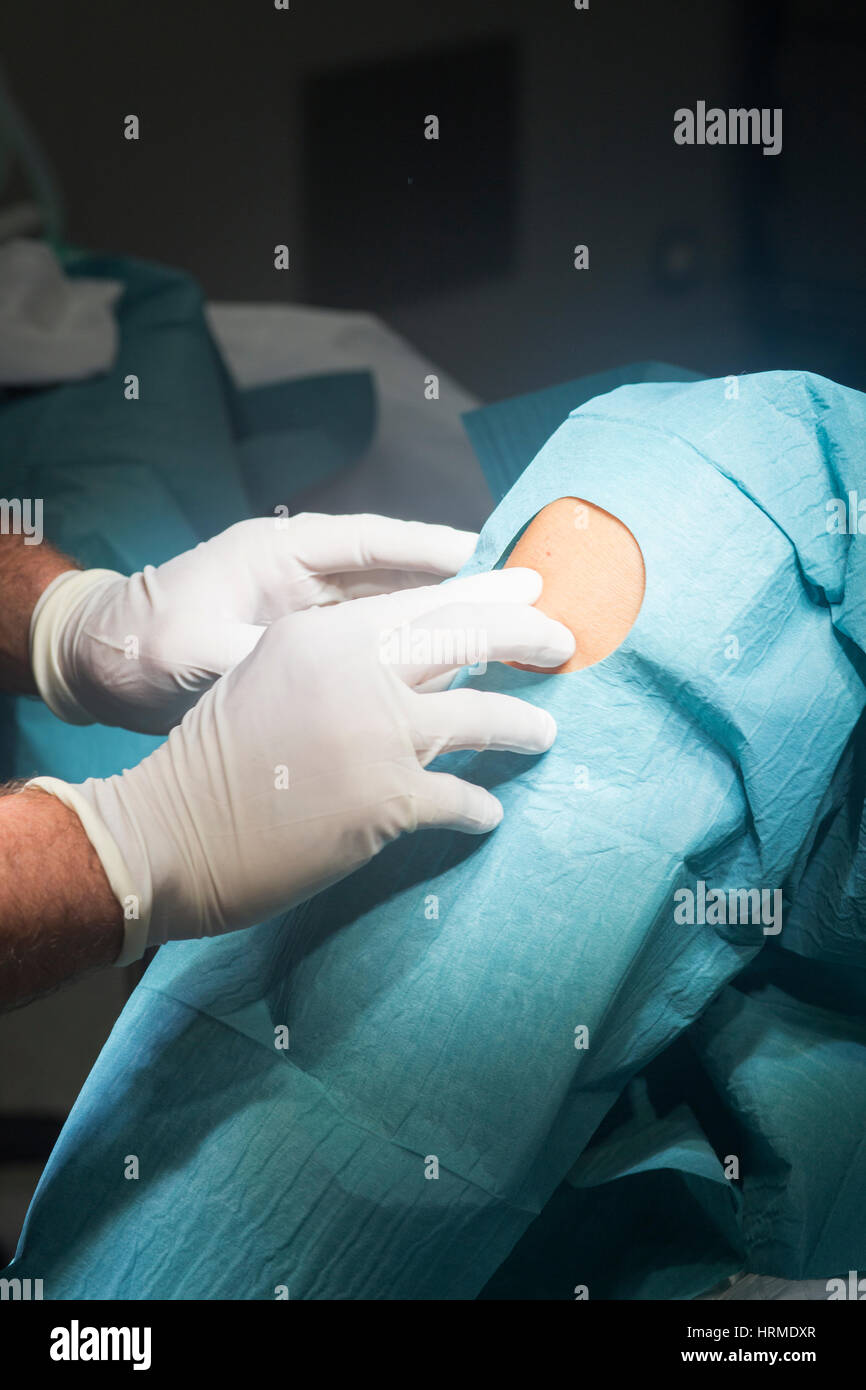 Preparación para la cirugía de rodilla hospital operación procedimiento médico en urgencias de quirófano. Foto de stock