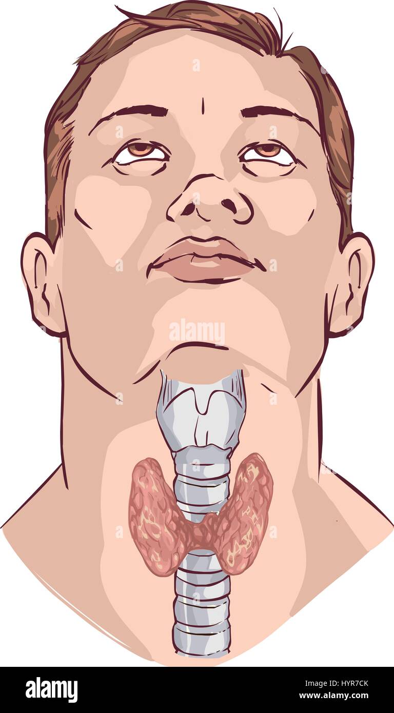 Глоток простой. Гортань. Щитовидная железа мультяшная. Гортань и щитовидная железа.
