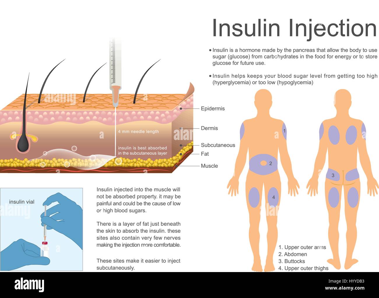 La insulina ayuda a que mantiene su nivel de azúcar en la sangre aumente demasiado alta o demasiado baja hiperglucemia hipoglucemia Ilustración del Vector