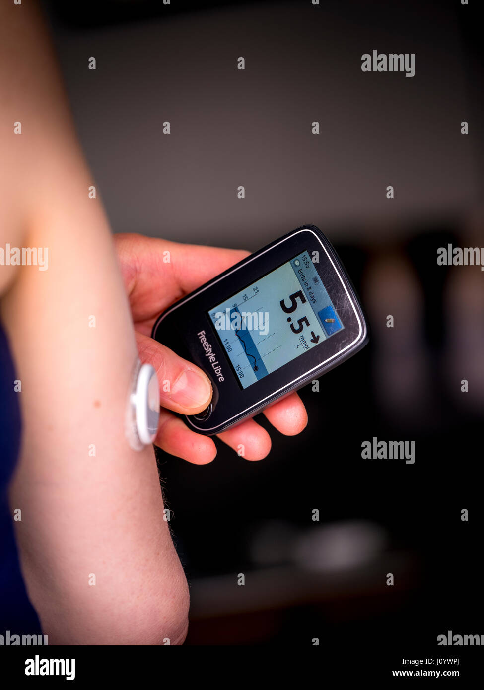 Una mujer con diabetes tipo 1 usando un monitor de glucosa flash denominada Freestyle Libre hecha por Abbott. Foto de stock