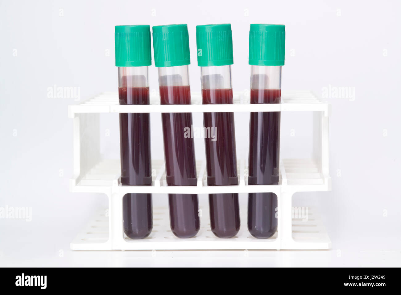 Baja presión de tubos vacutainer que contienen sangre para realizar pruebas Foto de stock