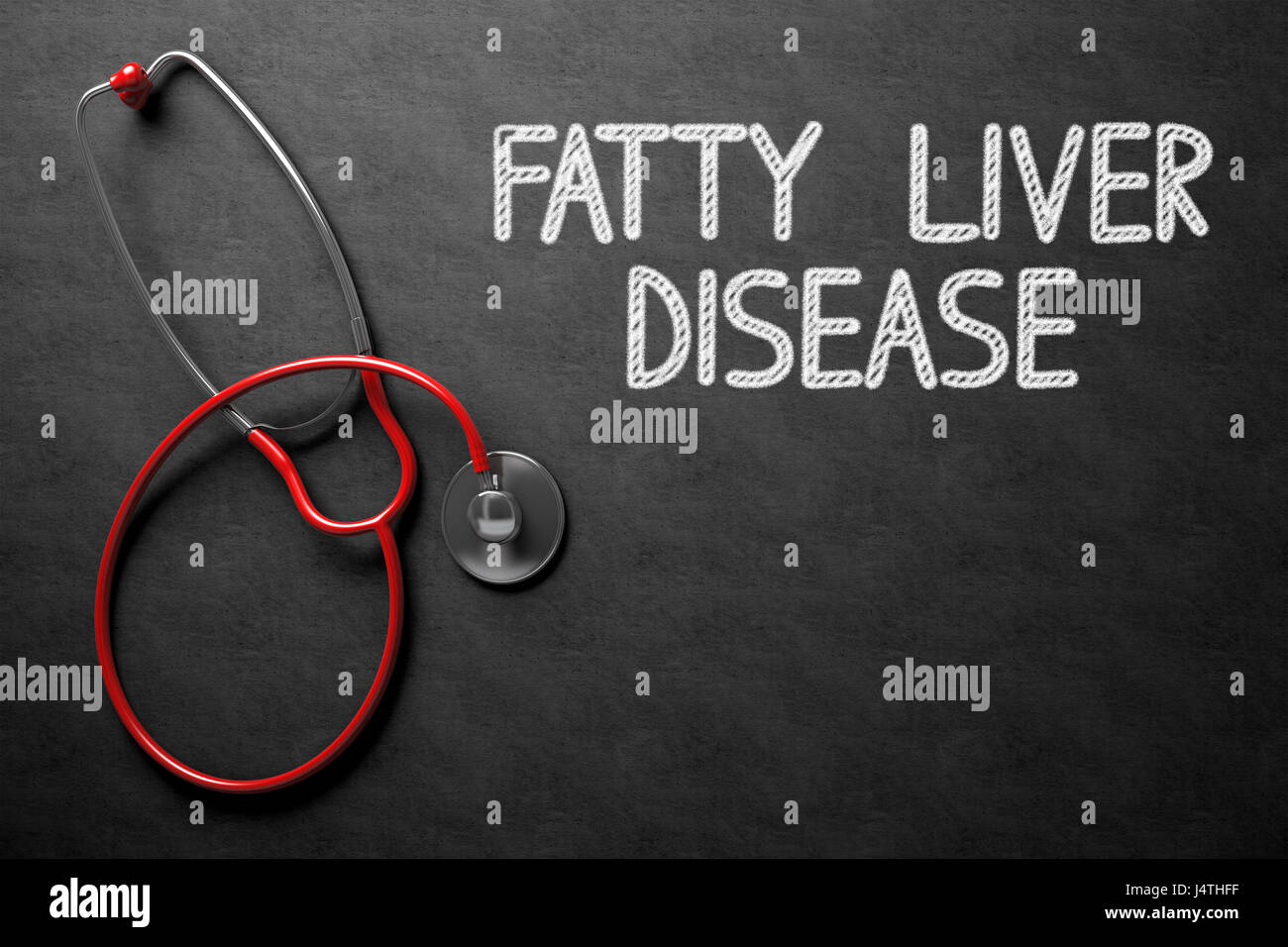 La enfermedad de hígado graso - Texto en la pizarra. Ilustración 3D. Foto de stock