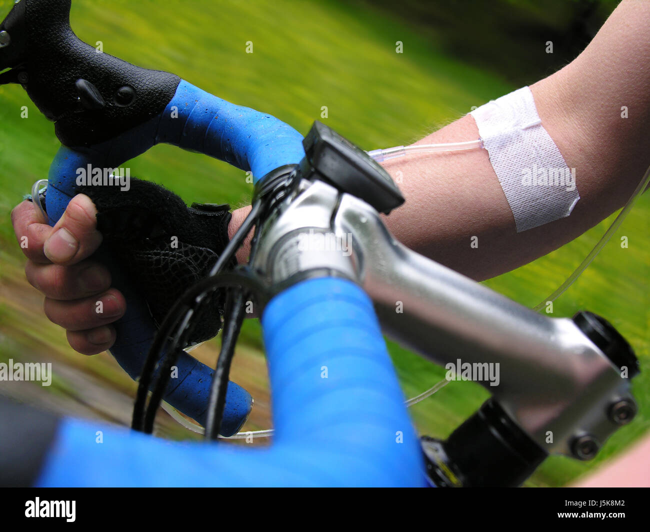 Rueda de carreras infusión de yeso brazo canula el manubrio de bicicleta de  carreras Fotografía de stock - Alamy