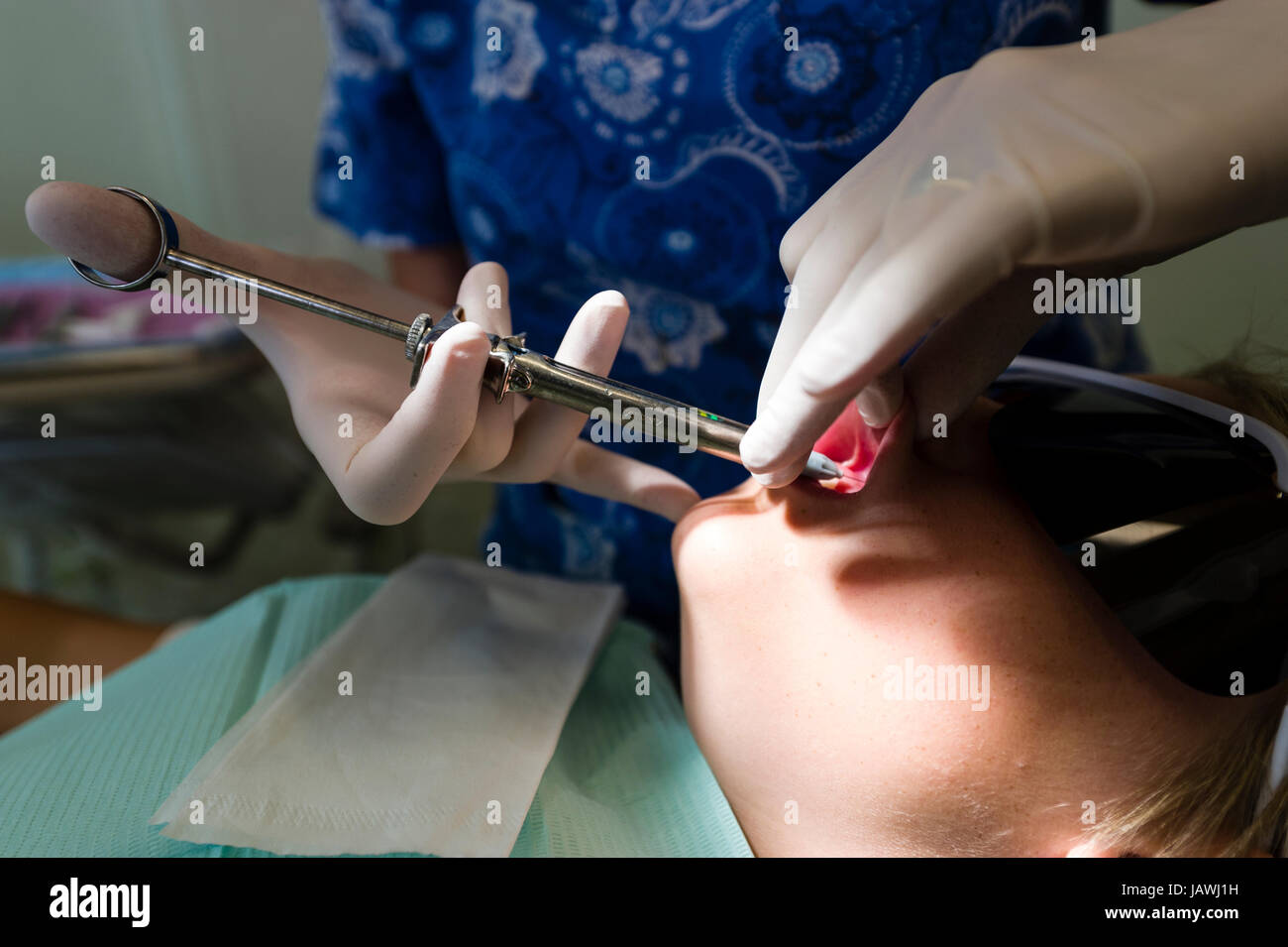 Un dentista inyecta un boys boca con anestesia para reparar un diente roto con una tapa. Foto de stock