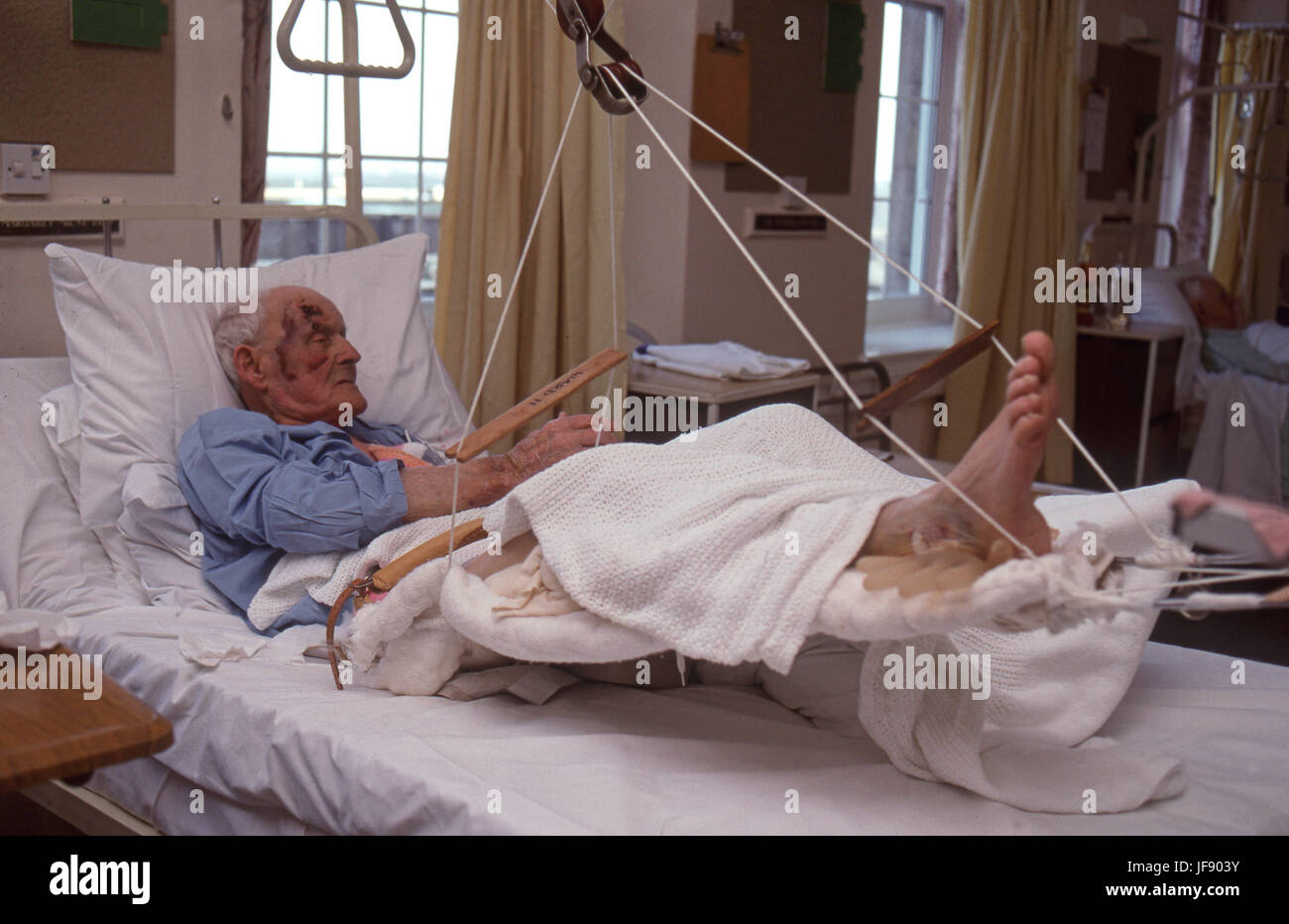 Anciano en un hospital después de un accidente Foto de stock