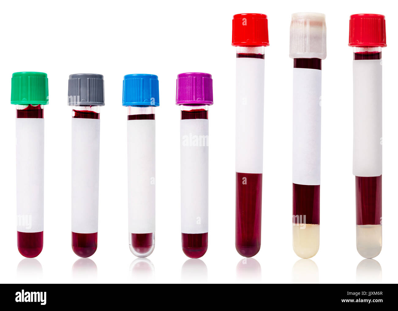 Tubo de sangre recogida. Tamaño y color diferente de sangre el tubo con la  muestra de sangre para probar aislado sobre fondo blanco Fotografía de  stock - Alamy