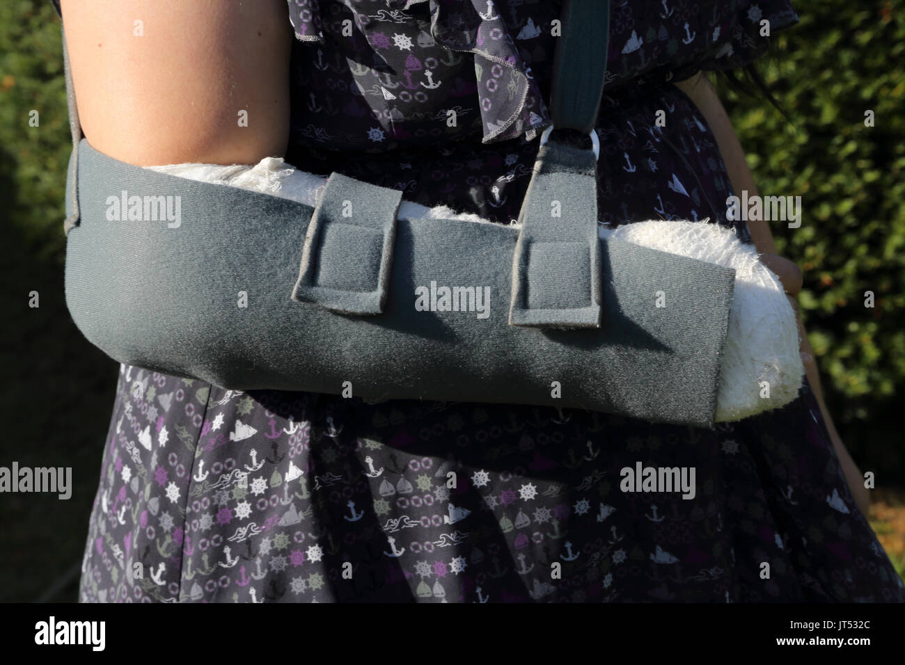 Mujer con el brazo en cabestrillo tras una operación en su muñeca Surrey, Inglaterra Foto de stock