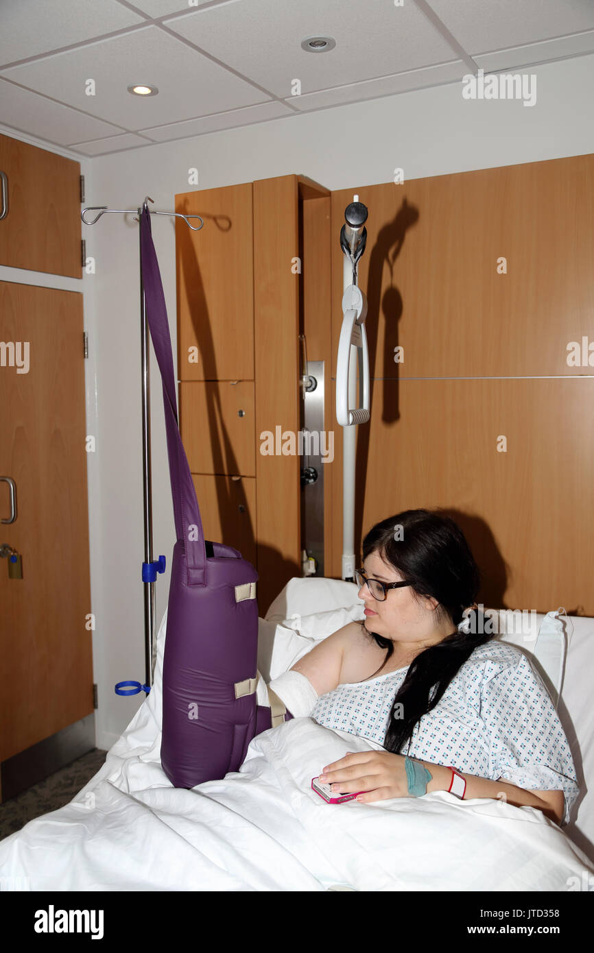 Mujer en el hospital con el brazo levantado en un yeso después de la operación en su muñeca Surrey, Inglaterra Foto de stock