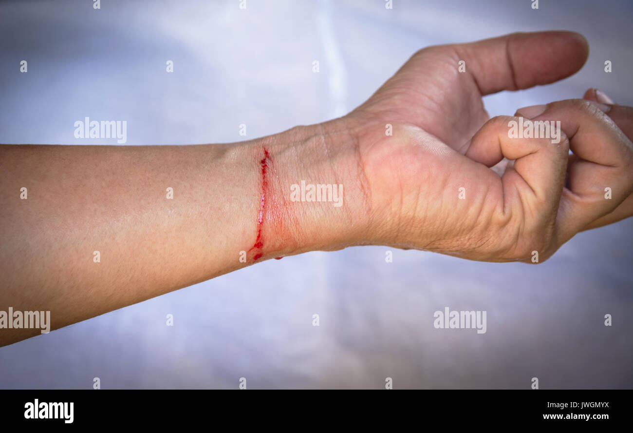La mano llena de sangre y la muñeca cortada sobre tela blanca representan  el sentimiento herido. mala relación concepto Fotografía de stock - Alamy
