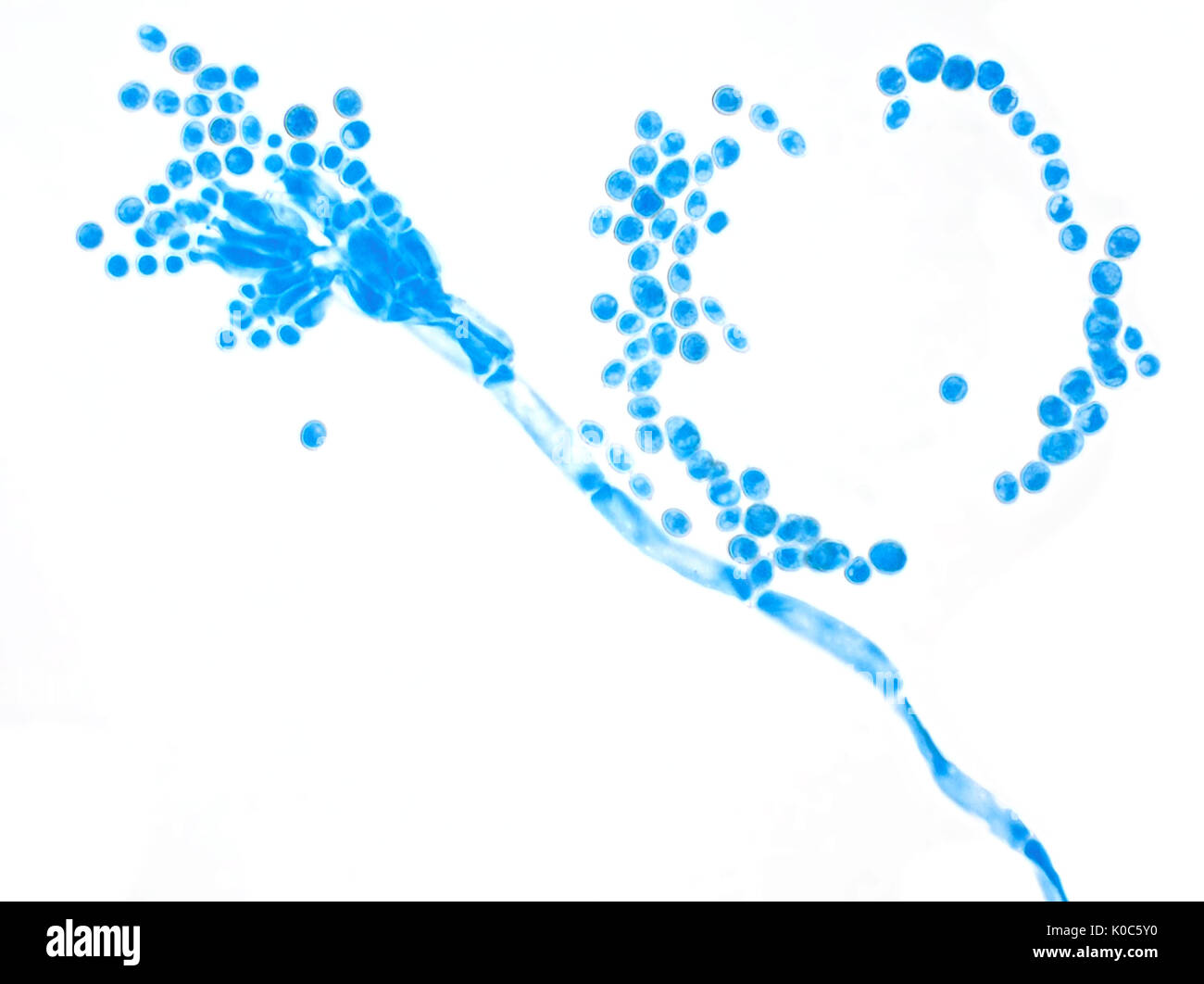 Micrografía de campo brillante de Penicillium molde (teñidos con bromuro de azul), la foto es de unos 160 micrómetros de área amplia Foto de stock