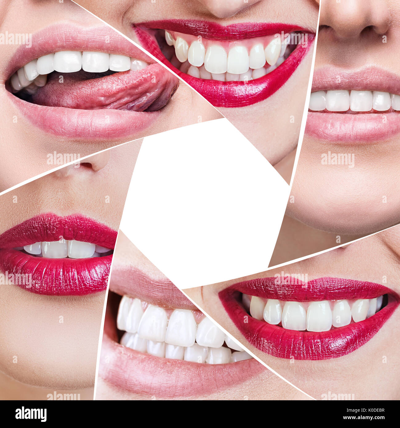 Collage de sonrisa saludable en forma de diafragma. Foto de stock