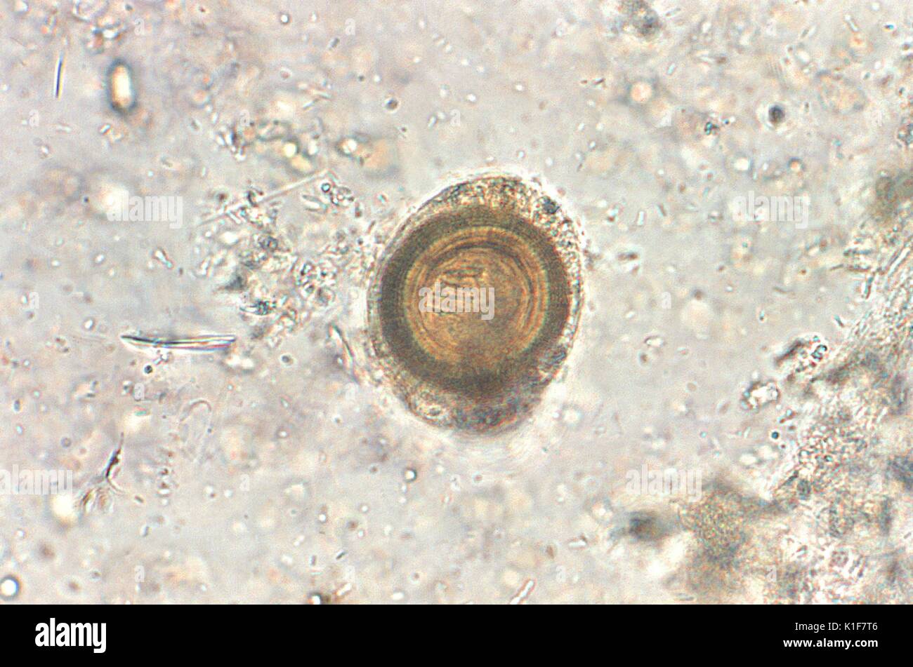 Huevo de taenia fotografías e imágenes de alta resolución Alamy Huevo de taenia fotografías e imágenes de alta resolución Alamy