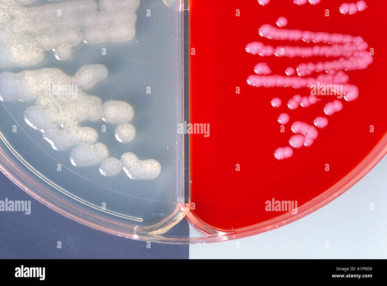 Placa de agar sangre fotografías e imágenes de alta resolución - Alamy