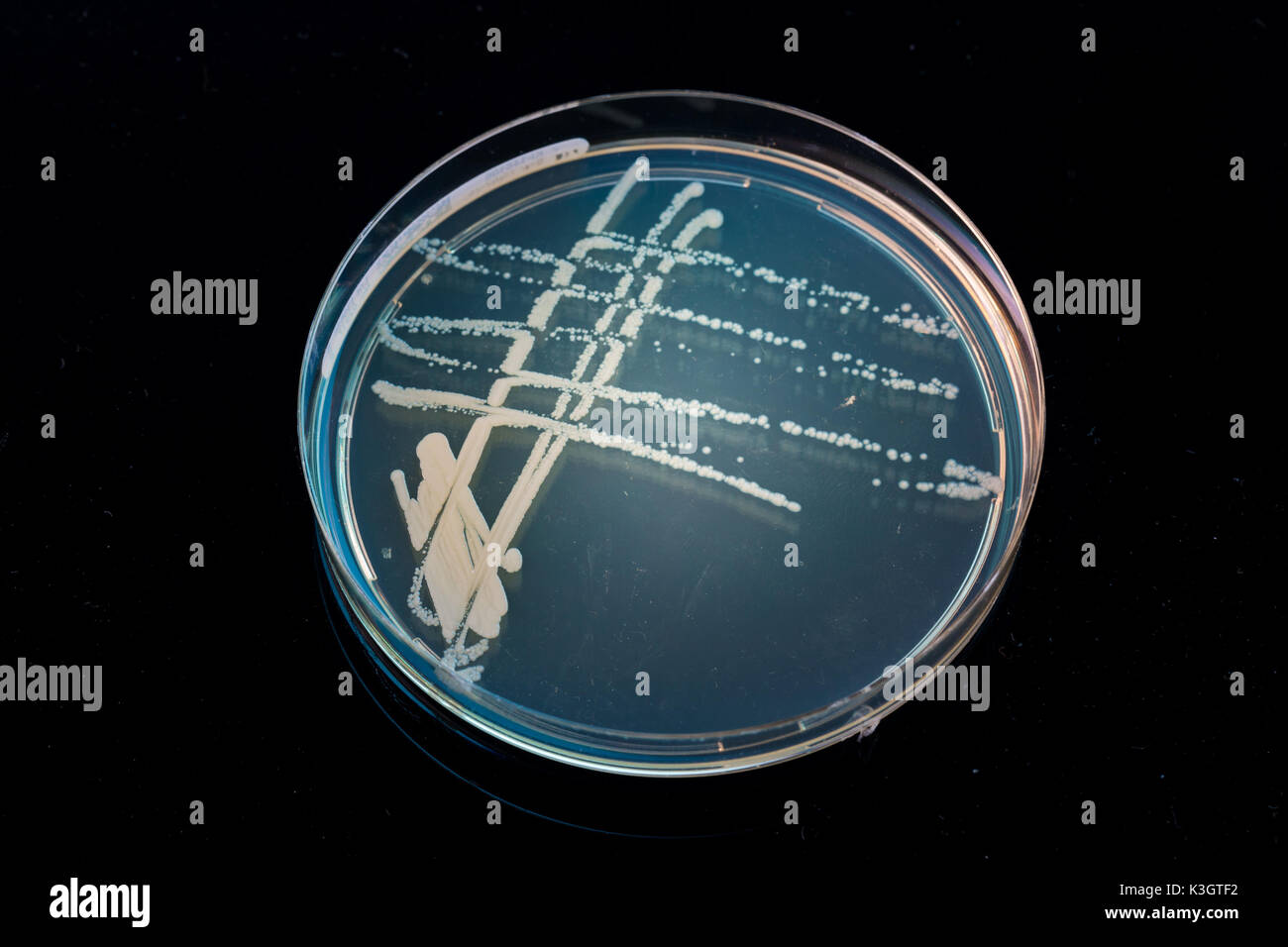 Montón de petri con cultivos de crecimiento de microorganismos en el doctor mano , hongos y microbios. Una placa Petri ( Petrie plato. Placa de Petri o en cultivos celulares Foto de stock