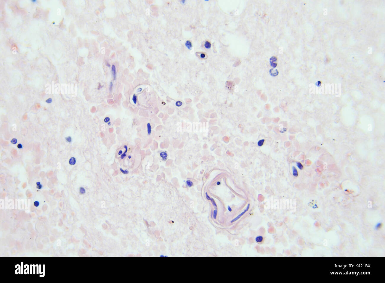 Vista microscópica de tejido cerebral aumento de x400 Foto de stock