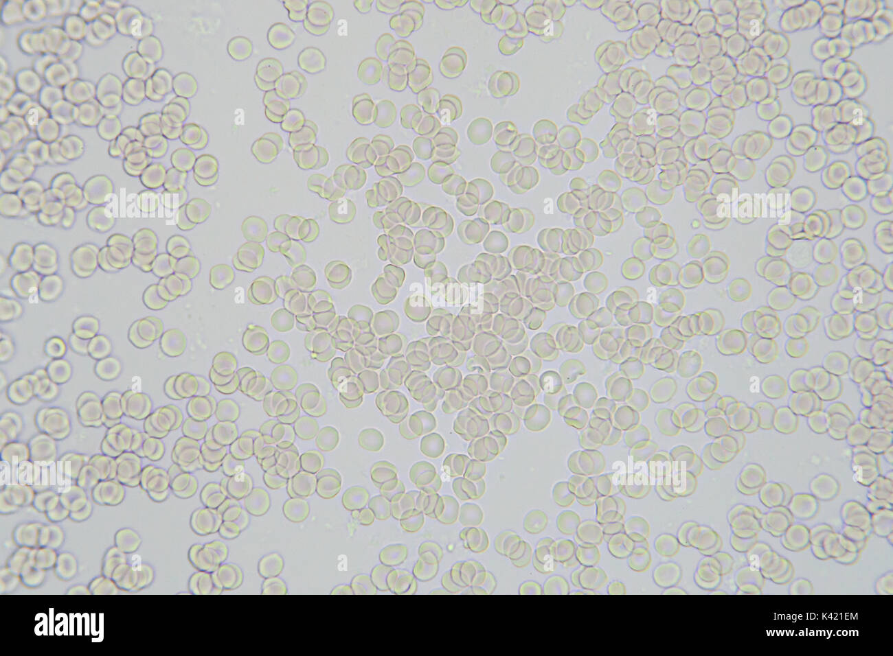 Ampliación de imagen microscópica de las células de la sangre x 400 Foto de stock