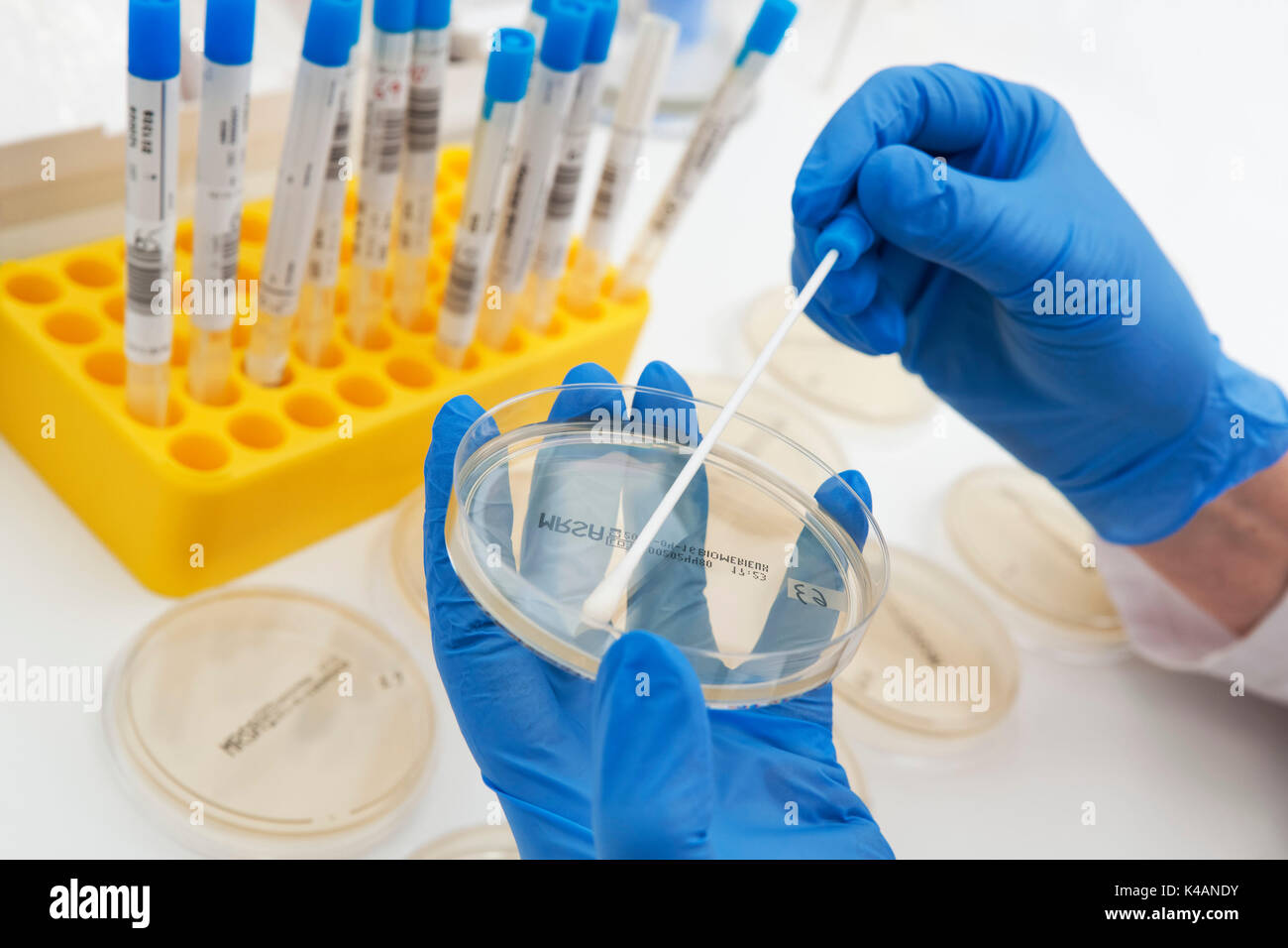 Frotis de mucosas es cultivadas en placas de petri, diagnóstico microbiológico de mrsa gérmenes resistentes a meticilina ( Foto de stock