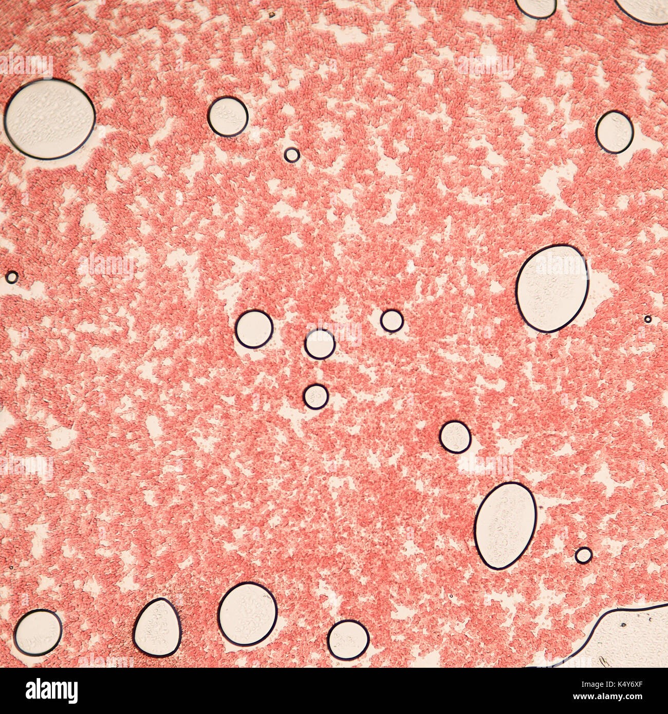 Un frotis de sangre bajo el microscopio presentan los neutrófilos y  linfocitos rojos. foto micro secciones con alta magnificación con  microscopio de luz Fotografía de stock - Alamy