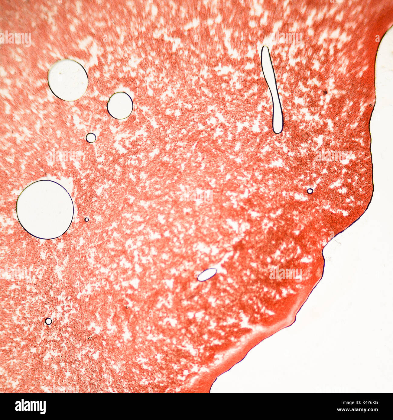 Un frotis de sangre bajo el microscopio presentan los neutrófilos y linfocitos rojos. foto micro secciones con alta magnificación con microscopio de luz Foto de stock