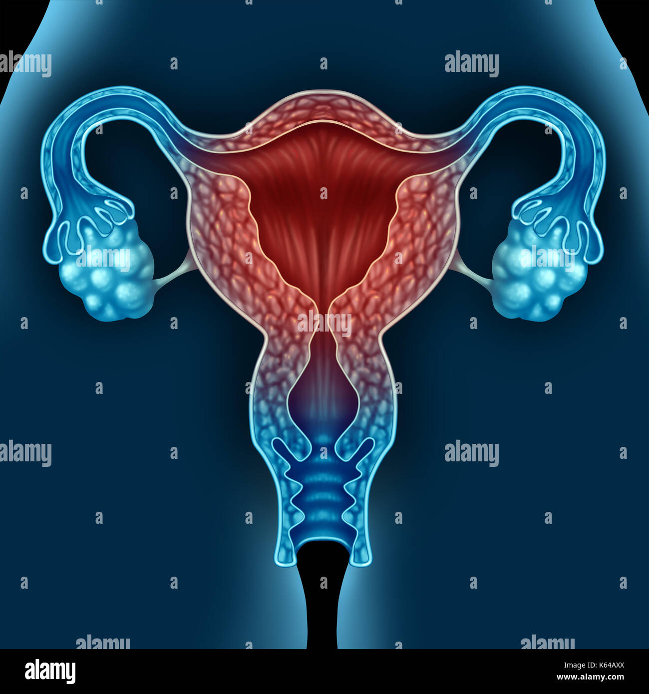 La menopausia femenina condición médica debido al envejecimiento como un útero humano como una condición de la menopausia concepto en una ilustración 3d elementos. Foto de stock