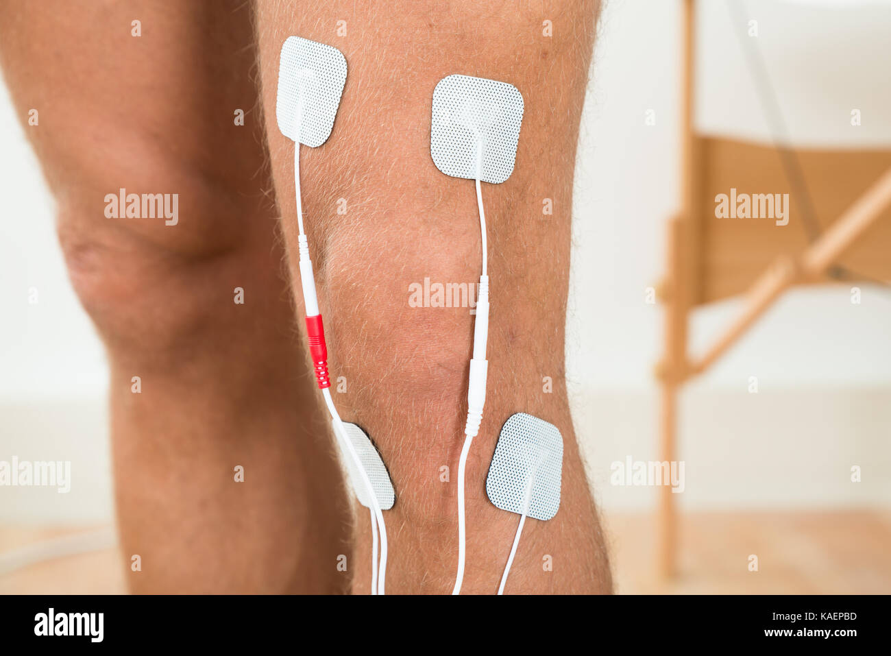 Electro estimulación con electrodos electrodos en el centro médico de fisioterapia  fisioterapeuta en las rodillas de altos paciente con reumatismo y artritis  Fotografía de stock - Alamy