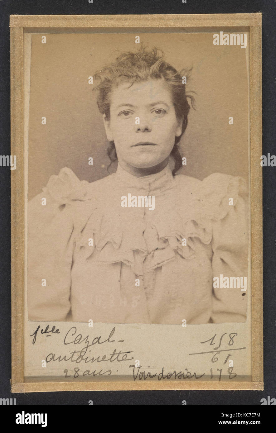 Cazal. Antoinette. 28 ans, née à Salgouz (Cantal). Couturière. Anarchiste. 28/2/94., Alphonse Bertillon, 1894 Foto de stock