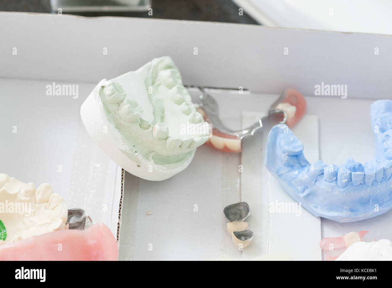 Muestra clínica dental instrumentos en uso para cuestiones de ortodoncia. cuidado dental y concepto de tratamiento Foto de stock