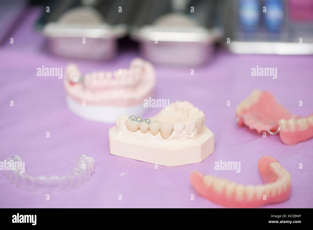 Muestra clínica dental instrumentos en uso para cuestiones de ortodoncia. cuidado dental y concepto de tratamiento Foto de stock