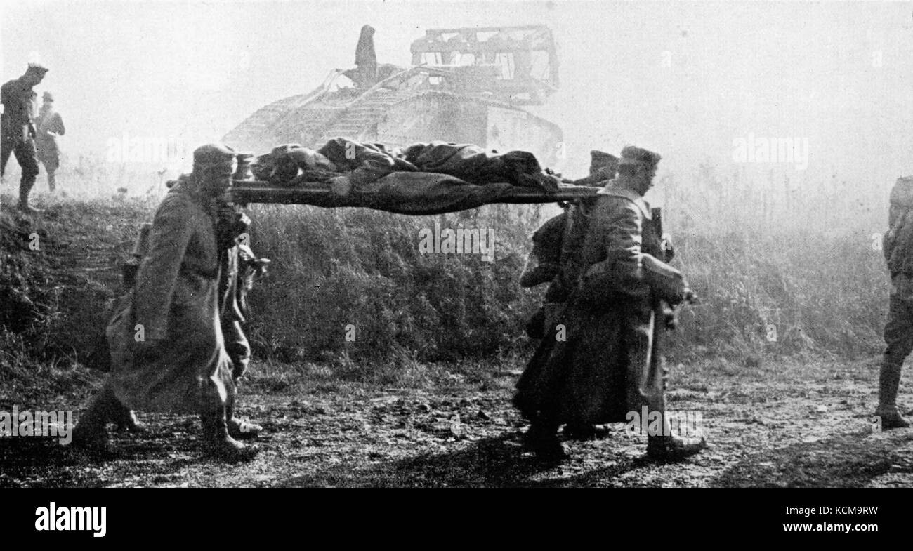 Collier Guerra Mundial de 1921 prisioneros alemanes traer American heridos Foto de stock