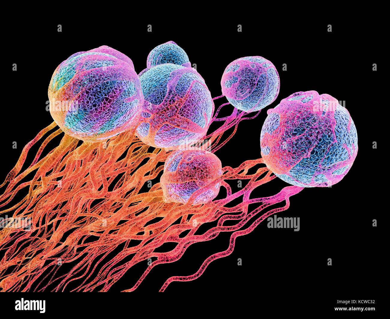 Las células cancerosas. Equipo ilustración de las células cancerosas,  mostrando la formación de vasos sanguíneos proporcionando las celdas con  los oxígenos y nutrigens. Las células con sus núcleos mostrados en azul  Fotografía